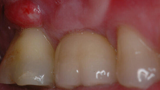 AIE propone: Caso Clinico 1