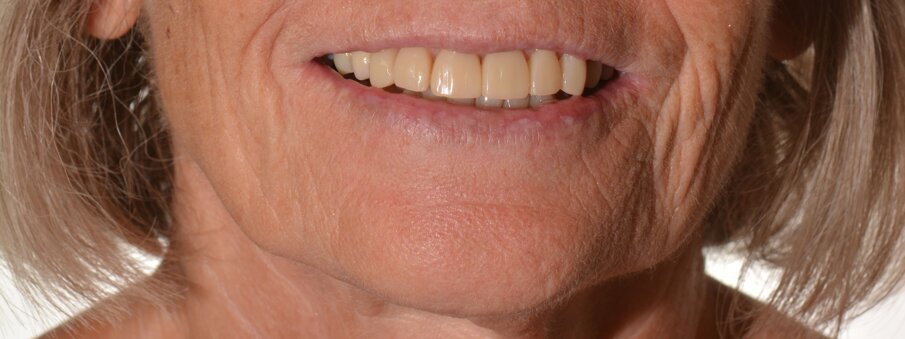 Tevreden patiënt = tevreden tandarts.