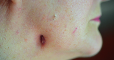 “Find it, fix it, and leave it alone”