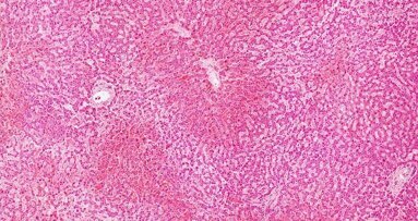 Gas koji uzrokuje neprijatan zadah omogućuje uzgoj matičnih ćelija dobijenih iz zuba