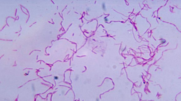 口腔病原体会助长癌细胞抵抗免疫细胞的能力