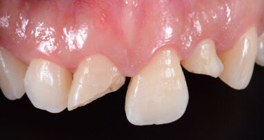 Snellire la lavorazione in laboratorio? Servono validi protocolli