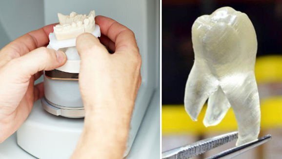 Pesquisadores desenvolvem material de impressão antimicrobiano 3-D