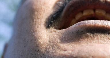 California Dental Association recommends oral cancer screening