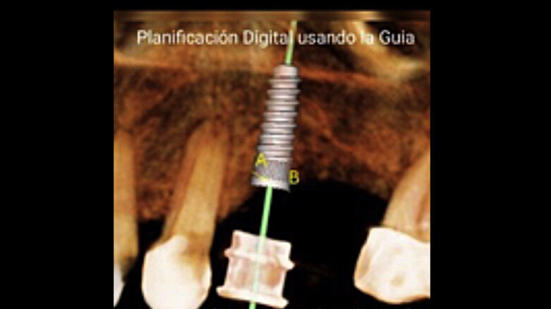 El odontólogo debe detectar precozmente las enfermedades de sus pacientes