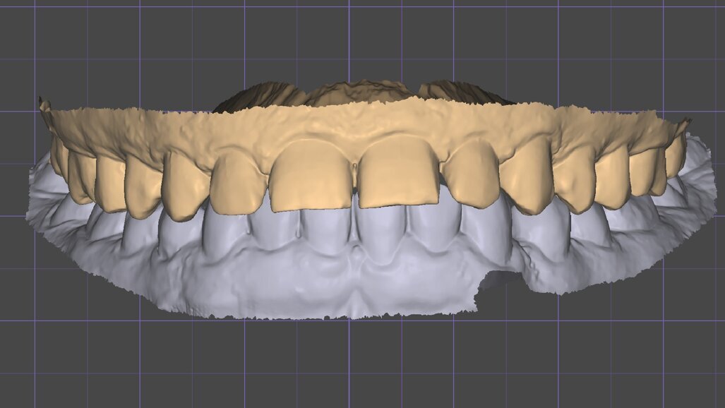 La prima visita odontostomatologica: un evento rivoluzionato dalla moderna tecnologia digitale