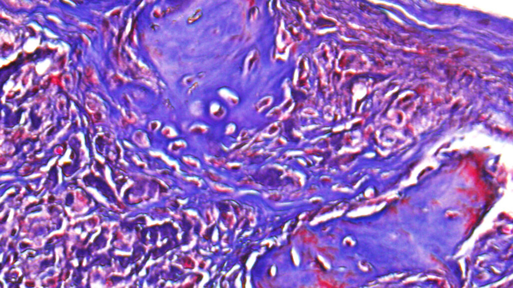 New hydrogel shows promise in dental and craniofacial tissue engineering