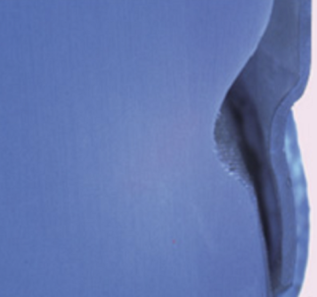 Fig. 13i: The thermoformed PETG aligner shows poor fit at the cervical third.