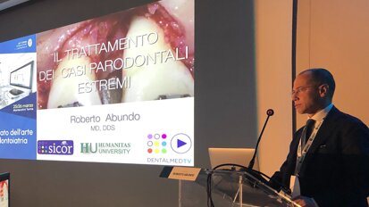 Il trattamento dei casi parodontali estremi: videointervista al dott. Roberto Abundo