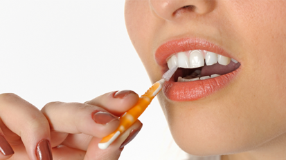 SSO: Studie zu Interdentalzahnbürsten