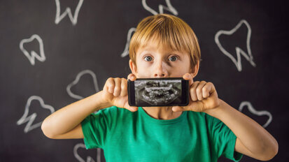 New AI platform radically improves detection of early childhood caries New AI platform radically improves detection of early childhood caries