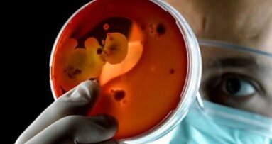 Streptococco, i consigli degli esperti