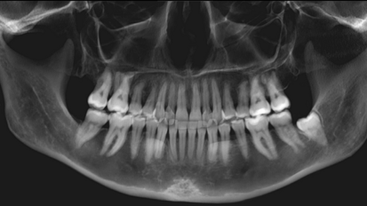 Test title autop New title