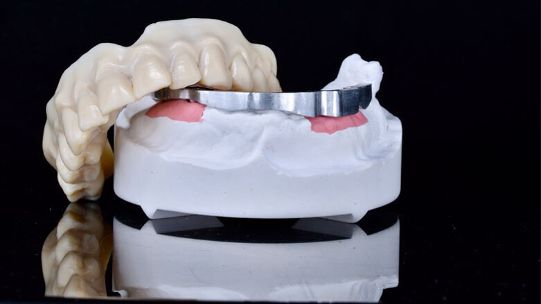 Utilizzo della stampante 3D in un flusso di lavoro totalmente digitale