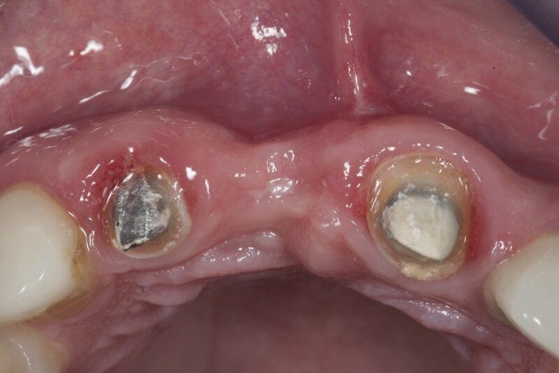 Ryc. 3_Stan pierwotny.