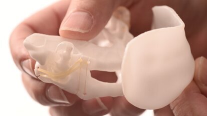 La postura de la lengua en los trastornos del sueño