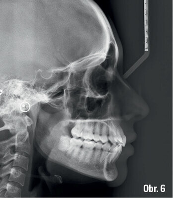 Kazuistika - popis v textu