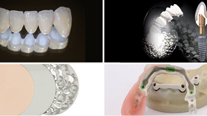 Materiál nové generace – BioHPP, který vyvinula firma bredent GmbH