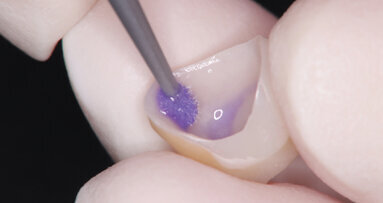 The importance of dental cleaners The importance of dental cleaners