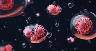 Reducing aerosol viral load to minimise spread of SARS-CoV-2 in dental clinics