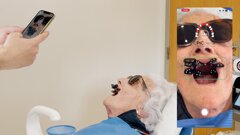 PIC dental: 15 años impulsando la fotogrametría en implantología