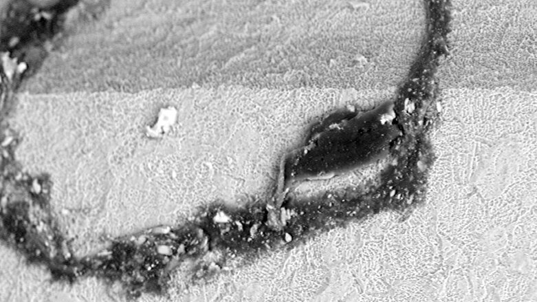 Is your dental implant system truly safe and clean?