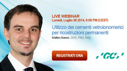 Utilizzo dei cementi vetroionomerici rivestiti per ricostruzioni dentarie permanenti