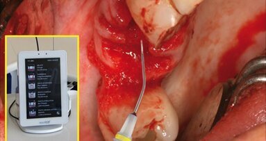 Chirurgie reconstructrice lasers assistée en omnipratique