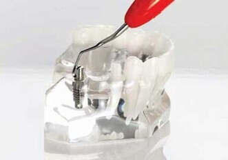 LM-Dental – ErgoMix Mini Implant Instruments