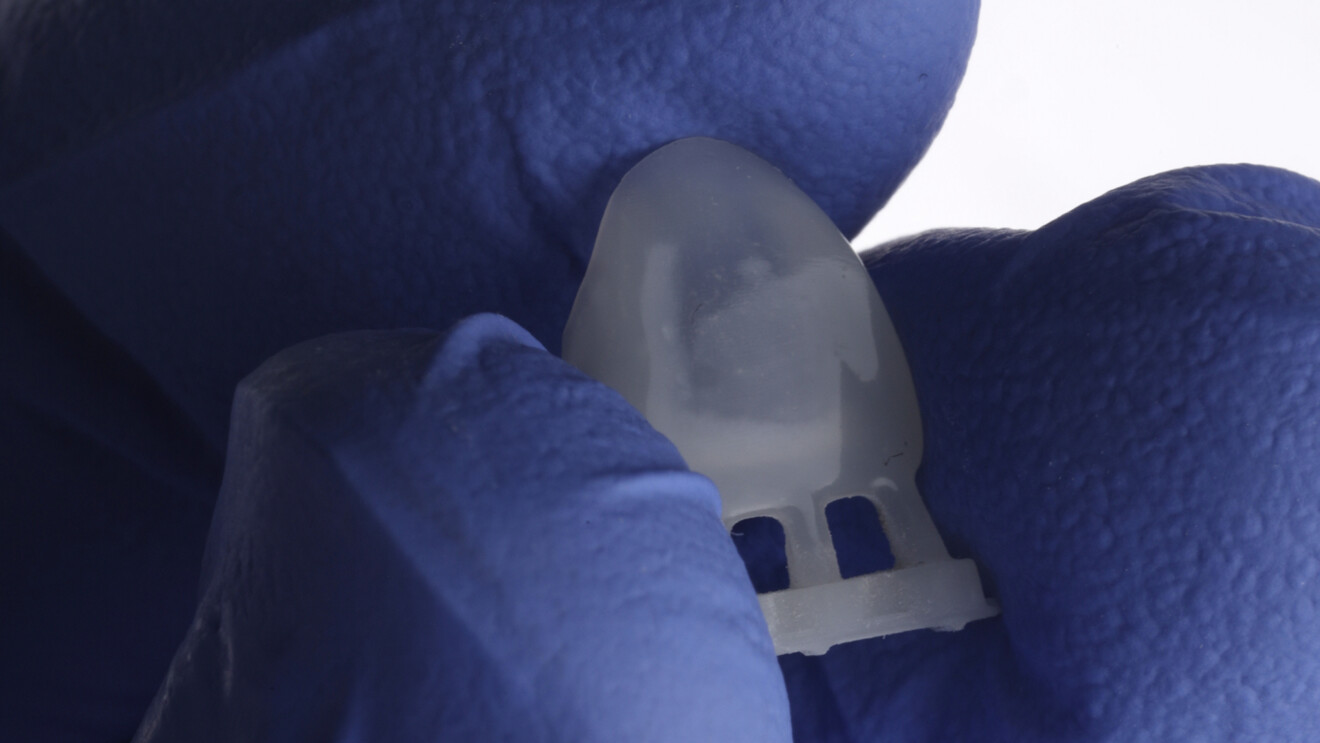 Fig. 4c: Veneer before support removal and finishing.
