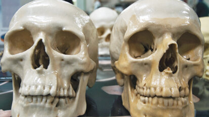 Dental clues assist in effort to identify USS Monitor remains Dental clues assist in effort to identify USS Monitor remains