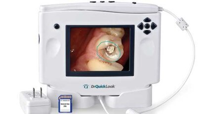 Using DrQuickLook SD for an implant presentation Using DrQuickLook SD for an implant presentation