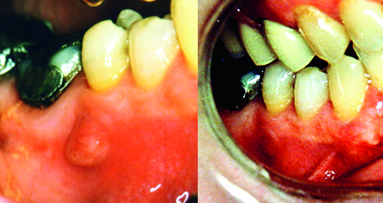 Long-term analysis of primary, non-surgical root canal treatments – A retrospective study