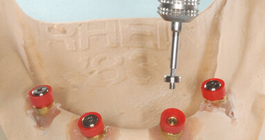 Ot Cap normo-micro e Ot Equator. Attacchi a sfera filettati intercambiabili con guaina da incollare