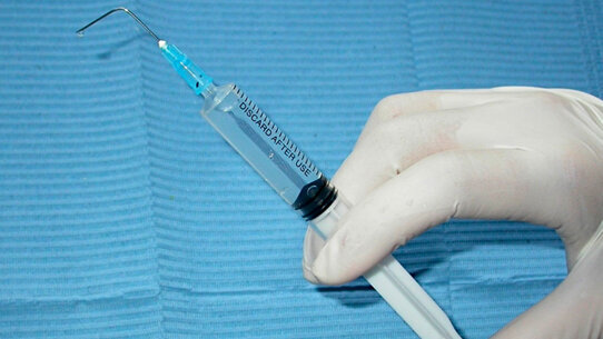 L’irrigazione canalare nell’endodonzia moderna: casi semplici