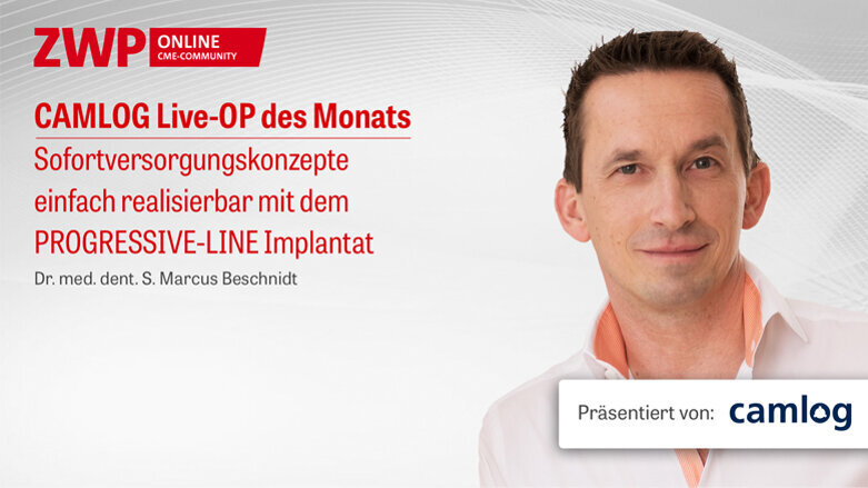 1 CME-Punkt: CAMLOG Live-OP mit Dr. Beschnidt jetzt im Archiv