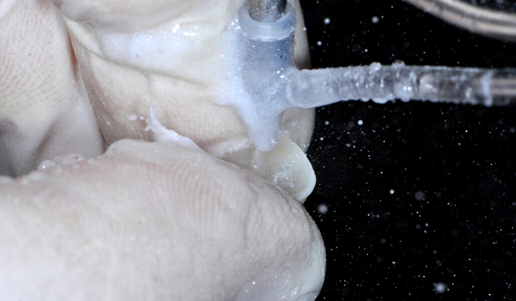 Fig. 13: Sandblasting of the intaglio surface of the overlay. 