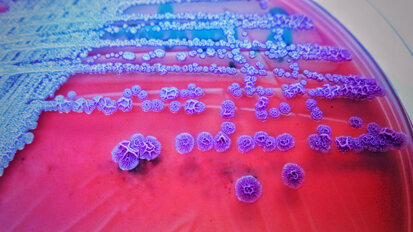 New summary of antimicrobial prescription guidelines available