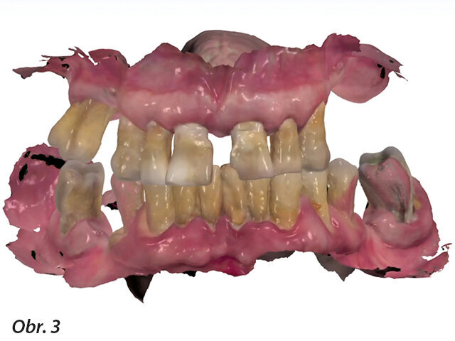 Kazuistika - iniciální situace