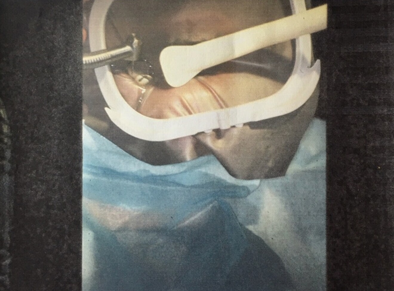 Fig. 5 : Contre la souillure des vêtements, une aspiration endobuccale est nécessaire. 