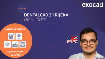 exocad – DentalCAD 3.1 Rijeka highlights