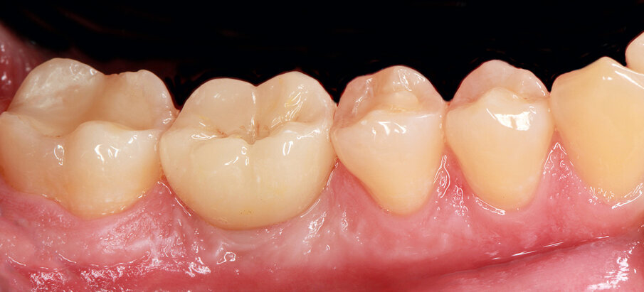 Fig. 33: Beautiful result in 2012