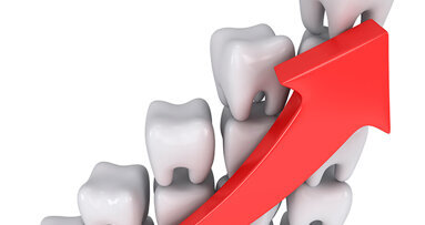 Il risveglio del dentale: trovare la crescita nel nuovo contesto di mercato