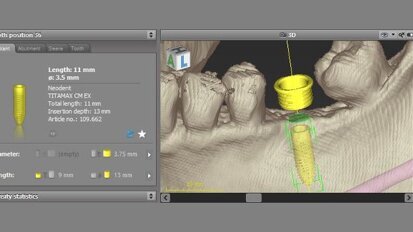 La biblioteca de implantes de Neodent disponible con el software coDiagnostiX