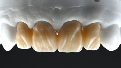 Une formule simple pour de merveilleux sourires