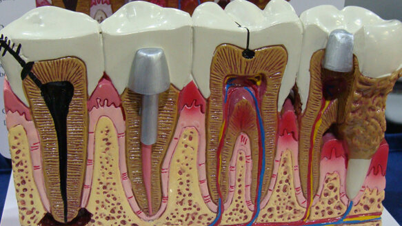 Meeting Review: 2016 Thomas P. Hinman Dental Meeting