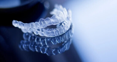 Align и Angelalign влизат в юридически спор