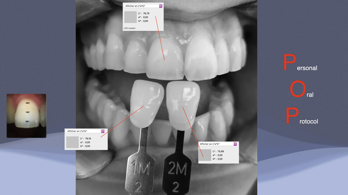 Fig. 2: Case example of digital photography expressed in CIELAB colour space values.
