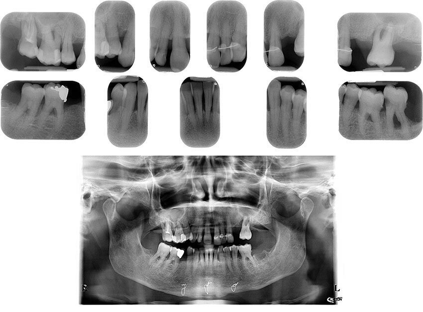 Figg. 1, 2_Situazione iniziale.