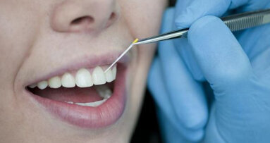 Riconoscere più velocemente gli agenti patogeni della parodontite con un modulo chip